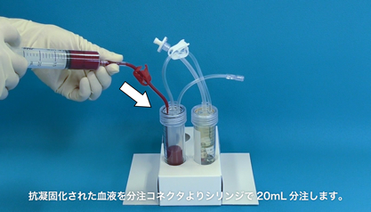 抗凝固化された血液を分注コネクタよりシリンジで20mL分注します。